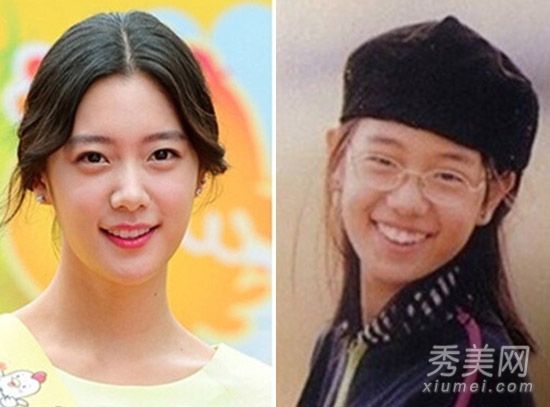 “亚洲第一美女”克拉拉·李整容前的照片