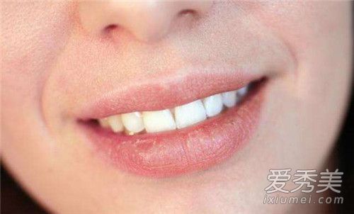 撕口皮的危害撕口皮会使嘴唇变厚吗