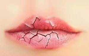 撕口皮肤会得白血病吗?长期撕口皮肤有什么后果