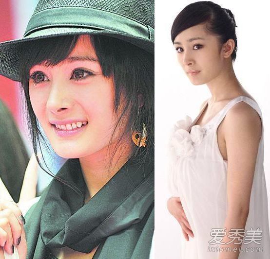 【整容后遗症】张含韵·辛屹的下巴在杨幂身上是一个“谜”