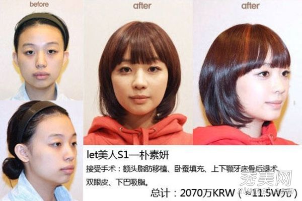 “让美丽”美容案例见证丑女成为女神