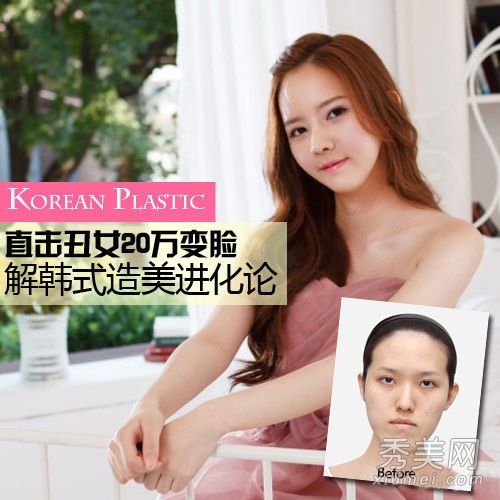 韩国“让美丽”揭秘整容前后的丑女