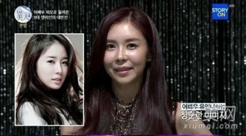 “让美丽”火焰胎记、丑女整容和刘仁娜整容