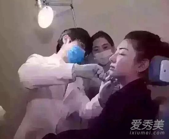 整容手术和透明质酸暴露在水晶中的照片改变了它们的外观