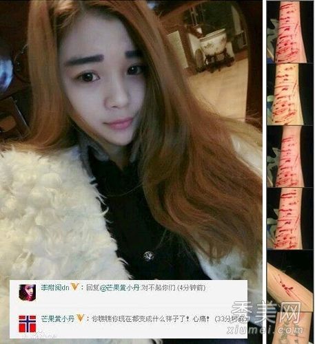 《变形记》主人公李耐阅怀疑整形手术失败+失恋自残