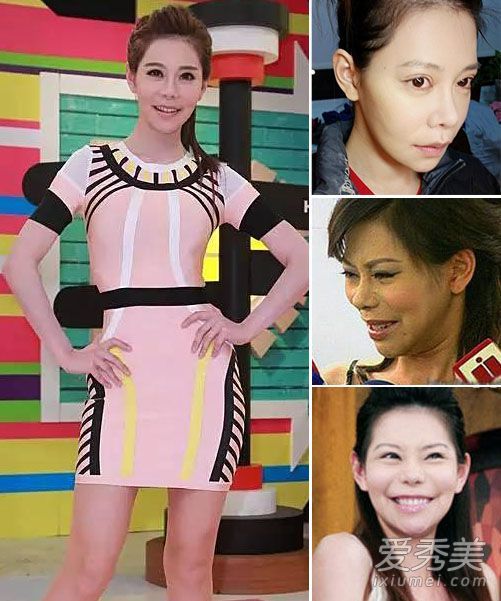 台湾明星赛络今年18岁，21年来做了60次整形手术。