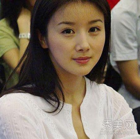 杨蜜,水晶,郑丽媛女演员整容失败后变丑