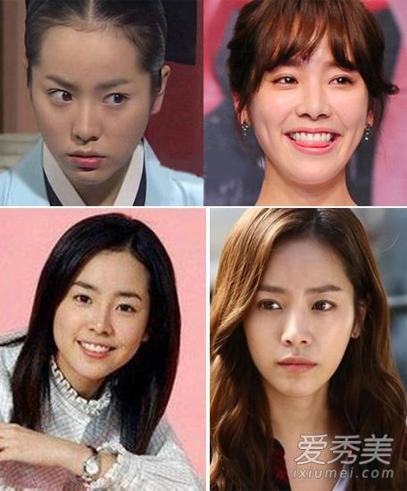 韩国女演员韩智敏·黄静茵·帕克·赵敏英整容成瘾