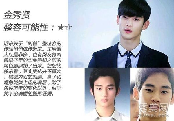 中韩男星整形美容手表机李敏镐华威刘鼻假