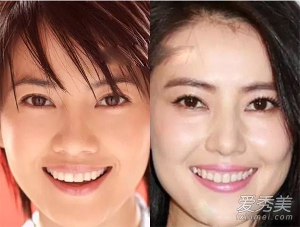 高媛媛甚至整了整自己的脸?人家只是微调了一下鼻子