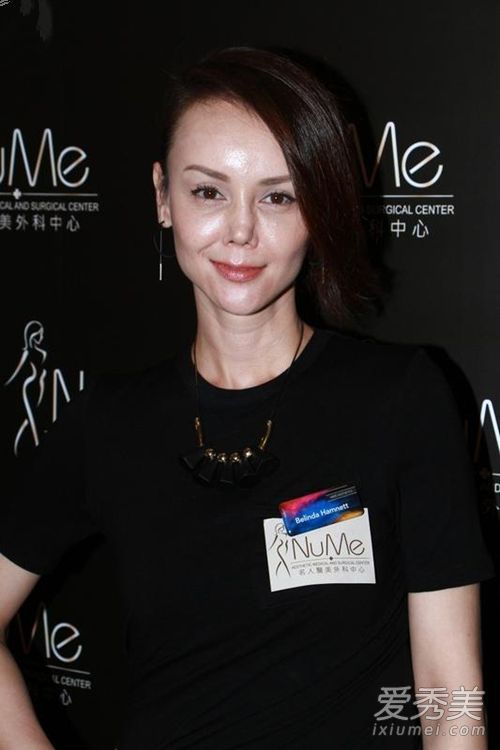 又一次整容失败。雅姐的鼻子像外星人一样凹陷