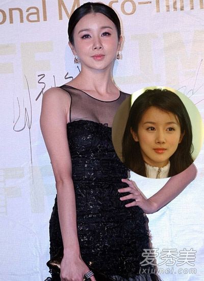 整形手术前后的明星照片变得残疾还是美丽?