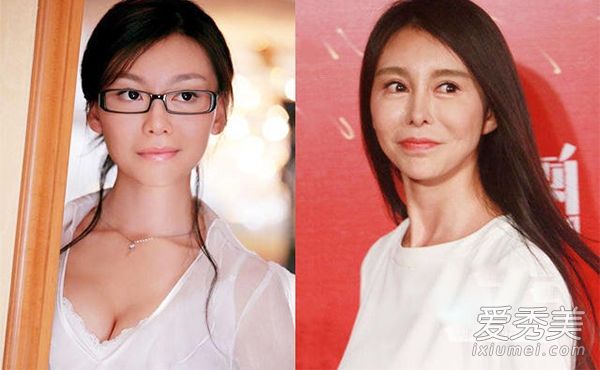 整形手术前后,明星们最喜欢谁?
