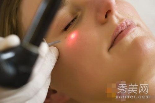 如何永久脱毛?揭示激光脱毛的五大后遗症