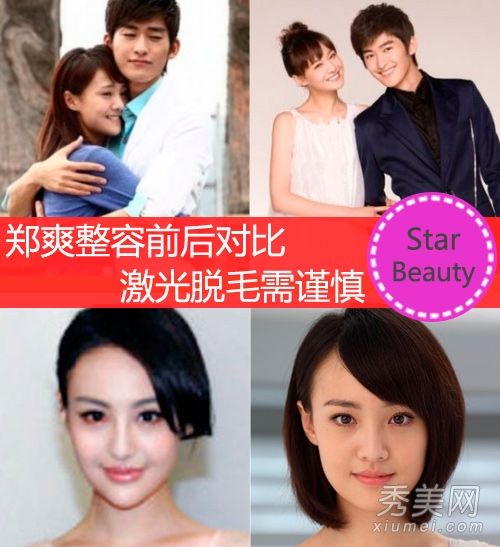 郑爽透露整形手术的细节