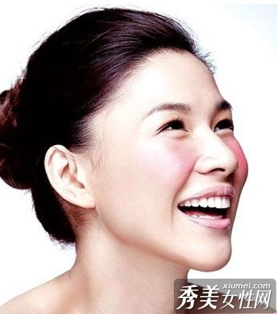 冬天教你6招对抗顽固红肿