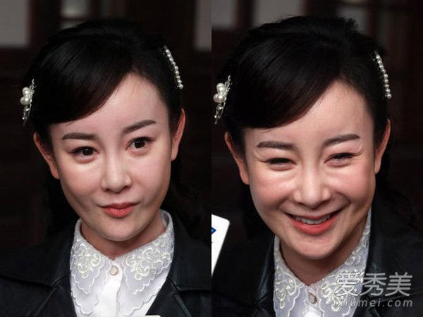 整个崩溃仍占多数!图为娱乐圈女性整容明星的现状