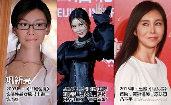 郑爽、纪敏佳和李小璐明星整容与变脸的比较