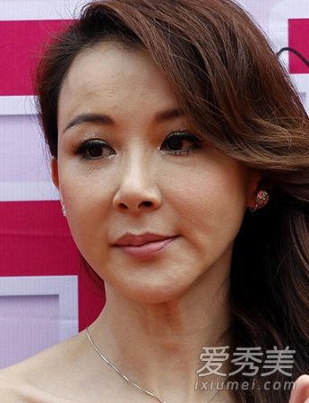 当美女接受整形手术时,肖强、王灏儿和崔智友更害怕