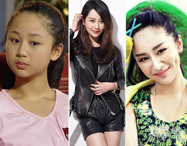 整容后哭泣的五大女明星!