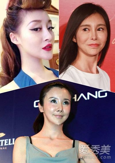吓死宝宝了!明星美容失败爆发后遗症