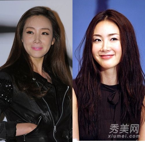 崔智友女明星整容比较