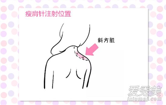 细肩针有多长时间效果?细肩针有什么副作用