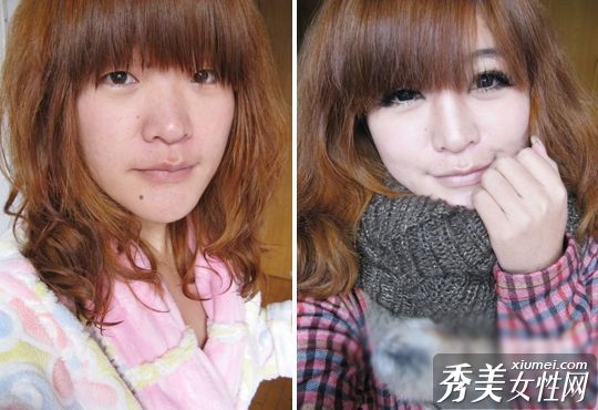 丑陋的畸形女人见证先进的美容技术