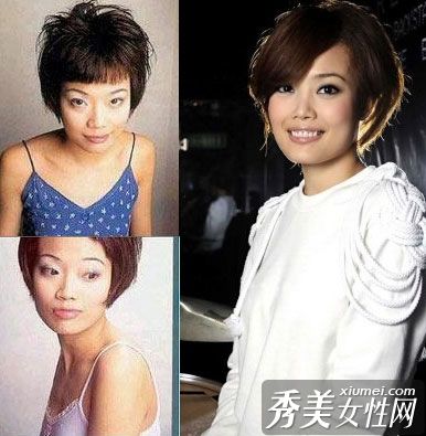 我不敢相信你中枪后没有做整形手术。