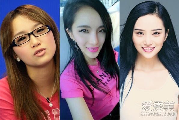 超女和快女整容:尚雯婕的脸僵硬，江映蓉的脸变了