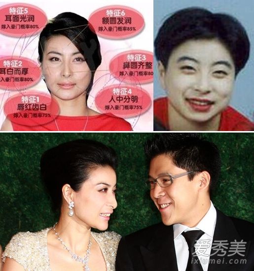 郭晶晶假货“王夫香”？整容手术细节揭晓