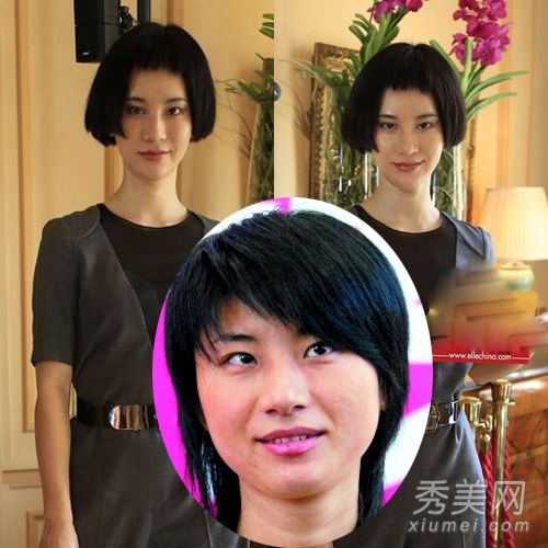 尚雯婕疑似切骨磨腮整形手术前后的照片