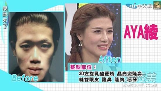 林志玲,陈乔恩,孙芸芸,台湾在整容手术中击败韩国