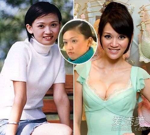 “金修远”整容前后面部+胸部尺寸变化惊人