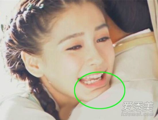 《风云之歌》婴儿整容揭示了下巴双眼皮太迷人了