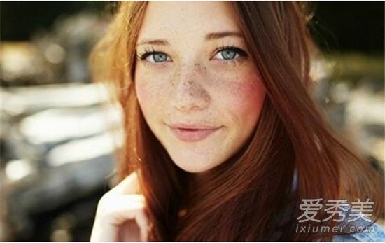 雀斑可以治愈吗?雀斑可以用激光治疗吗