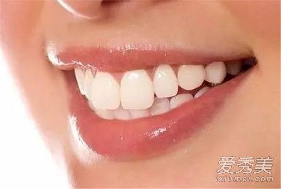 牙齿黄怎么美白牙齿黄?原因是什么