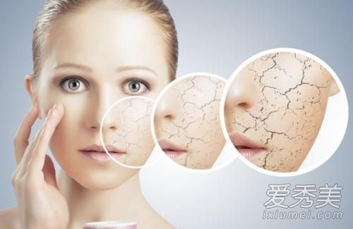 干性皮肤缺少什么维生素?什么对干性皮肤有好处