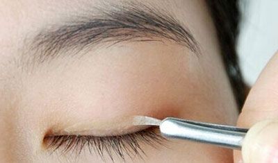 長期的雙眼皮貼可以變成雙眼皮嗎