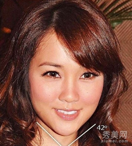 香港女演员整容+V形变脸