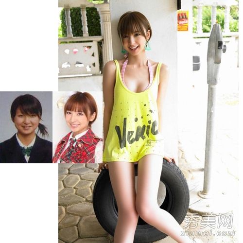 日本女孩AKB48組整形手術前後的比較