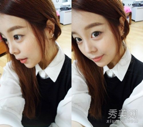 韩国女演员喜欢在她美丽的脸蛋后面做5次整形手术。