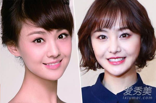 照片显示郑爽7年的“变脸历史”整形手术难以恢复