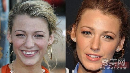 鼻子变得越来越小