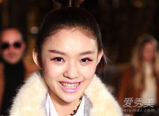 林允大黄牙惊网友牙齿黄是什么颜色的口红？