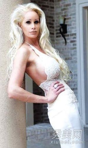 整容案例:32岁,44次,两个真正的芭比娃娃PK