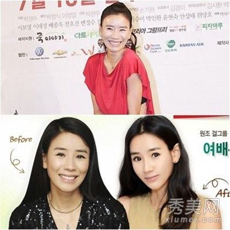 41岁的韩星尹贤淑20岁女孩整容对比