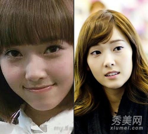 韩国女演员在整容手术后变成了一名年轻女性