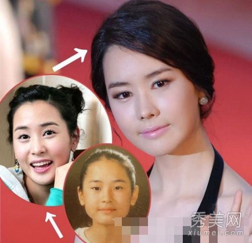 韩国女演员沉迷于整形手术,第二次整容失败后面部毁容