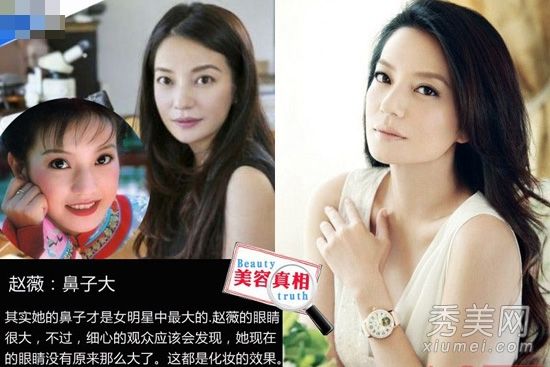 27位男女明星在化妆前后面临整形手术、秃顶和细纹